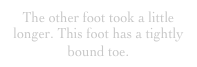 The other foot took a little longer. This foot has a tightly bound toe.